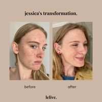 Lelive. Bestselling 3 Step Routine - Brighten, Clarify + Glow All Skin Types